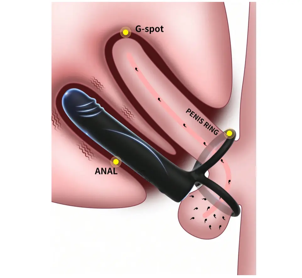Anal Plug Doble Penetracion Vibracion / batería 0213